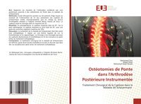 Produktbild: Ost&eacute;otomies de Ponte dans l'Arthrod&egrave;se Post&eacute;rieure Instrument&eacute;e