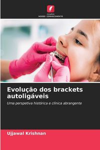 Produktbild: Evolu&ccedil;&atilde;o dos brackets autolig&aacute;veis