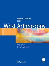 Produktbild: Wrist Arthroscopy