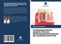 Produktbild: Evidenzbasierter Ansatz f&uuml;r die Entscheidungsfindung bei Zahnimplantaten