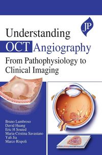Produktbild: Understanding OCT Angiography