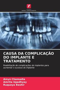 Produktbild: Chamadia, A: Causa Da Complica&ccedil;&atilde;o Do Implante E Tratamento