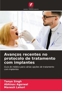 Produktbild: Avan&ccedil;os recentes no protocolo de tratamento com implantes
