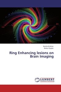 Produktbild: Ring Enhancing lesions on Brain Imaging