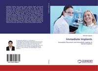 Produktbild: Immediate Implants