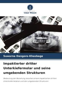 Produktbild: Impaktierter dritter Unterkiefermolar und seine umgebenden Strukturen