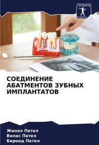 Produktbild: Soedinenie Abatmentov Zubnyh Implantatov
