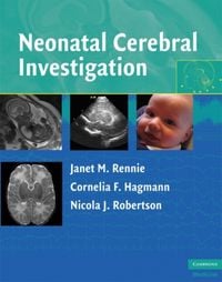 Produktbild: Neonatal Cerebral Investigation