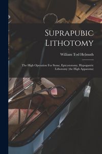 Produktbild: Suprapubic Lithotomy: The High Operation For Stone, Epicystotomy, Hypogastric Lithotomy (the High Apparatus)
