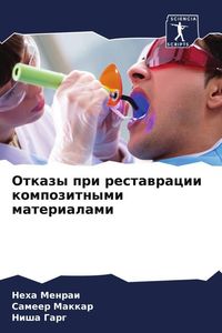 Produktbild: Otkazy pri restawracii kompozitnymi materialami
