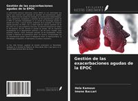 Produktbild: Gesti&oacute;n de las exacerbaciones agudas de la EPOC