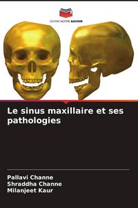 Produktbild: Le sinus maxillaire et ses pathologies