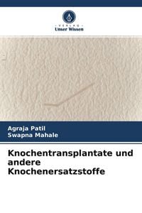 Produktbild: Knochentransplantate und andere Knochenersatzstoffe
