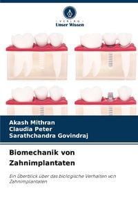 Produktbild: Biomechanik von Zahnimplantaten