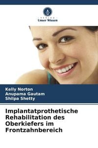 Produktbild: Implantatprothetische Rehabilitation des Oberkiefers im Frontzahnbereich
