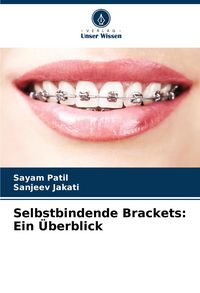 Produktbild: Selbstbindende Brackets: Ein &Uuml;berblick