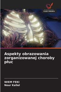Produktbild: Aspekty obrazowania zorganizowanej choroby p&iquest;uc