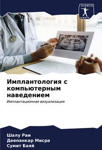 Produktbild: Implantologiq s komp'&uuml;ternym nawedeniem