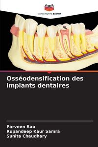 Produktbild: Oss&eacute;odensification des implants dentaires