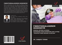 Produktbild: Fibrotomialaserem Diodowym