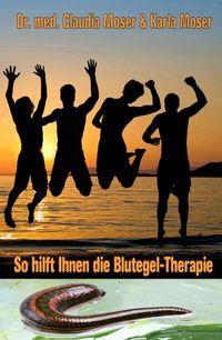 Produktbild: So hilft ihnen die Blutegeltherapie