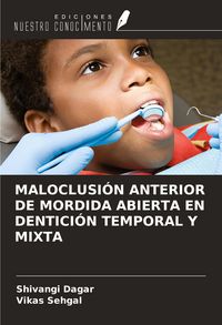 Produktbild: Maloclusi&oacute;n Anterior De Mordida Abierta En Dentici&oacute;n Temporal Y Mixta