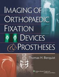 Produktbild: Imaging of Orthopaedic Fixation Devices and Prostheses