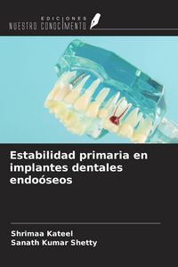 Produktbild: Estabilidad primaria en implantes dentales endo&oacute;seos