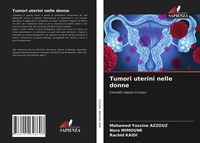 Produktbild: Tumori uterini nelle donne