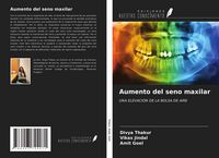 Produktbild: Aumento del seno maxilar
