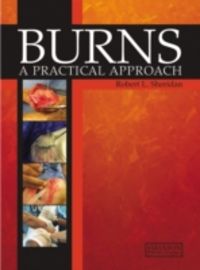 Produktbild: Burns: A Practical Approach