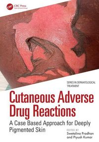Produktbild: Cutaneous Adverse Drug Reactions