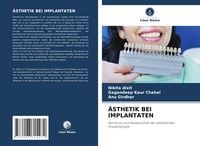 Produktbild: &Auml;sthetik bei Implantaten