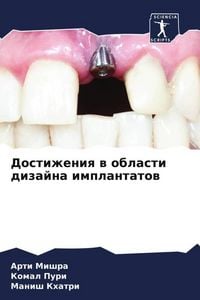 Produktbild: Dostizheniq w oblasti dizajna implantatow