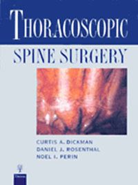 Produktbild: Thoracoscopic Spine Surgery
