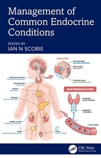 Produktbild: Management of Common Endocrine Conditions