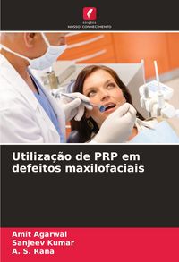 Produktbild: Utiliza&ccedil;&atilde;o de PRP em defeitos maxilofaciais