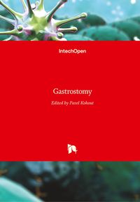 Produktbild: Gastrostomy