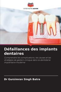 Produktbild: D&eacute;faillances des implants dentaires