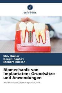 Produktbild: Biomechanik von Implantaten: Grunds&auml;tze und Anwendungen