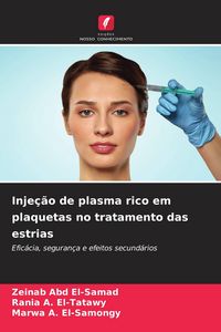 Produktbild: Inje&ccedil;&atilde;o de plasma rico em plaquetas no tratamento das estrias