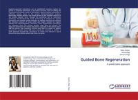 Produktbild: Guided Bone Regeneration