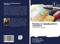 Produktbild: Viniry iz farforowogo laminata