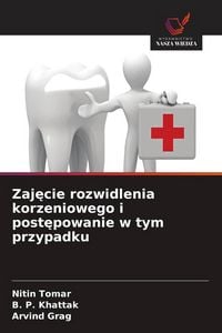 Produktbild: Zaj&iquest;cie rozwidlenia korzeniowego i post&iquest;powanie w tym przypadku