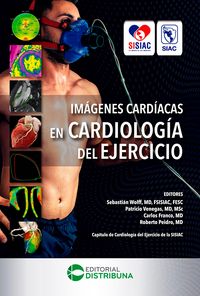 Produktbild: Im&aacute;genes Card&iacute;acas en Cardiolog&iacute;a del Ejercicio