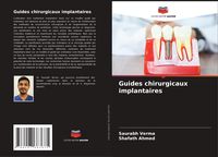 Produktbild: Guides chirurgicaux implantaires
