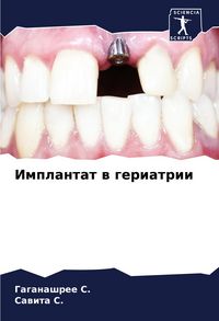 Produktbild: Implantat w geriatrii
