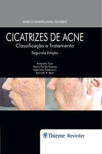 Produktbild: Cicatrizes de Acne
