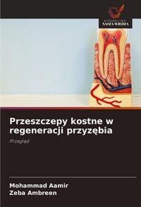 Produktbild: Przeszczepy kostne w regeneracji przyz&iquest;bia