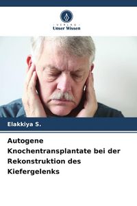 Produktbild: Autogene Knochentransplantate bei der Rekonstruktion des Kiefergelenks